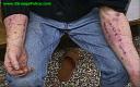 dependent de droguri